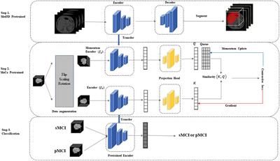 A Two-Stage Model for Predicting Mild Cognitive Impairment to Alzheimer’s Disease Conversion